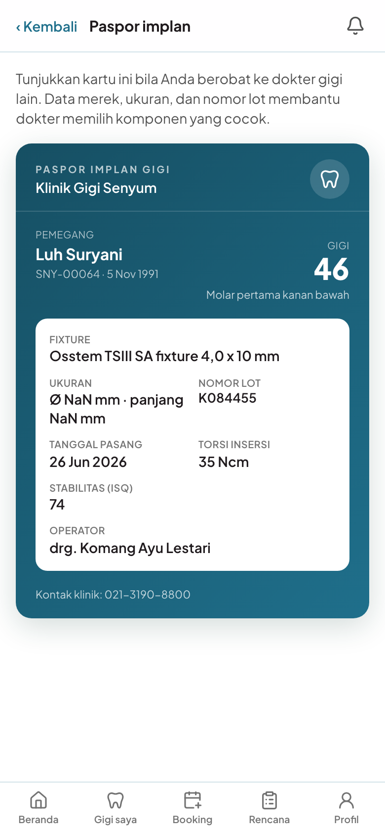 Paspor implan