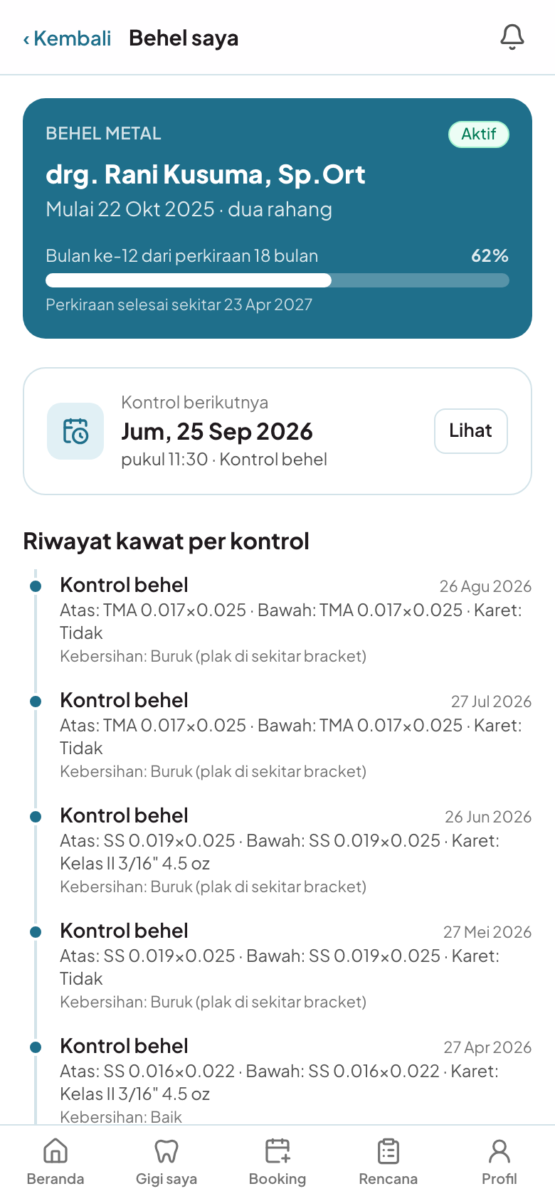 Progres behel dan aligner