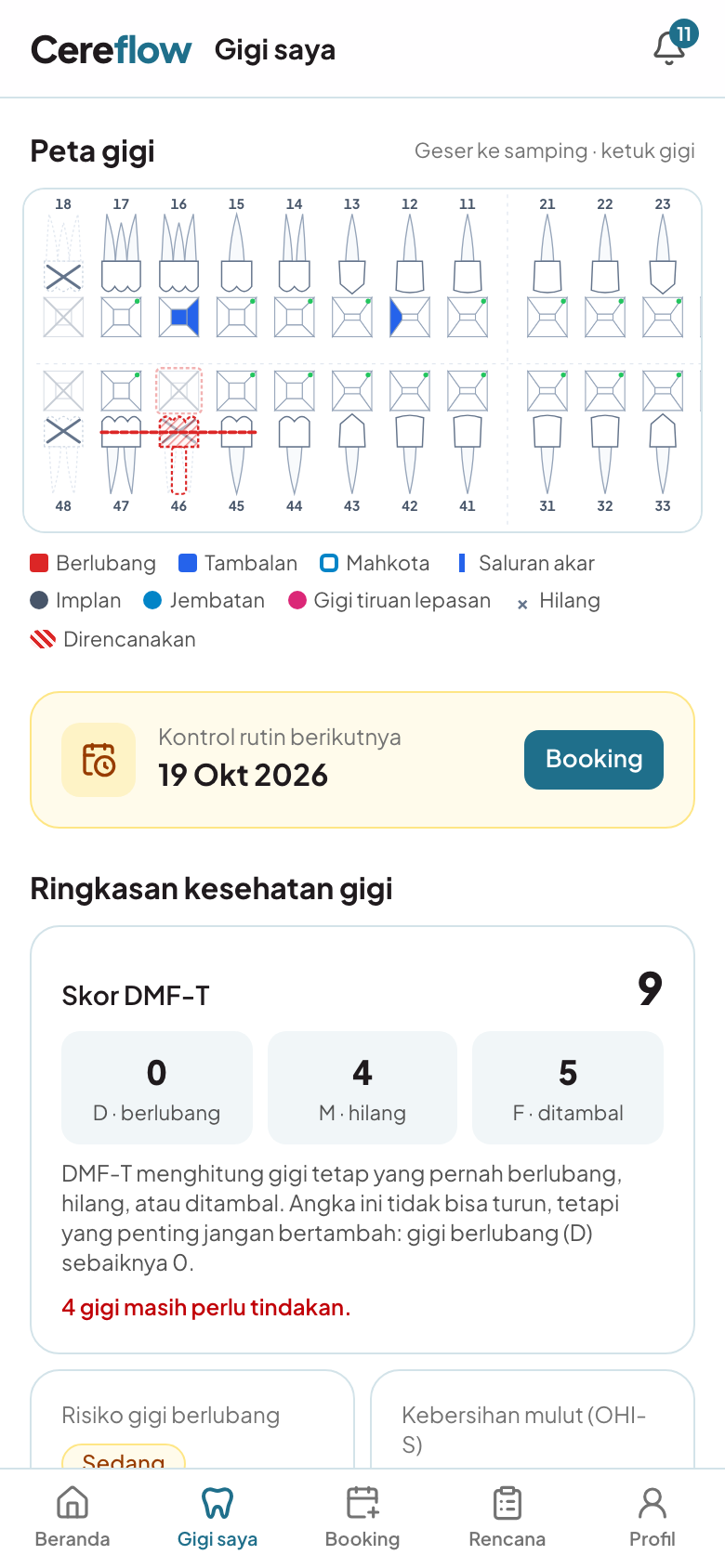 Gigi saya