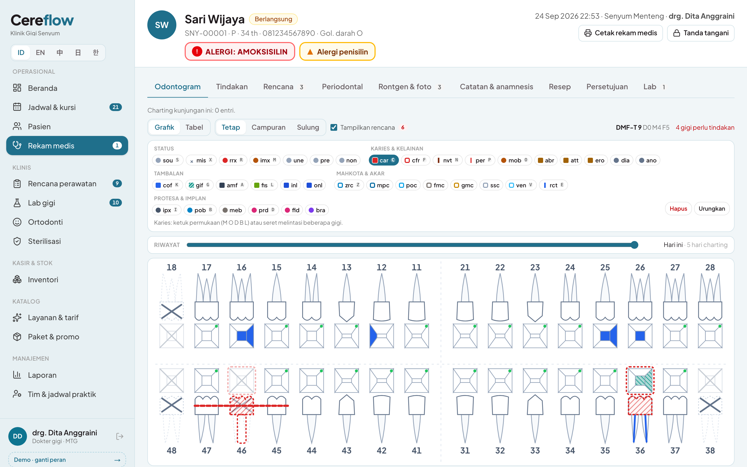 Odontogram per gigi dan per permukaan