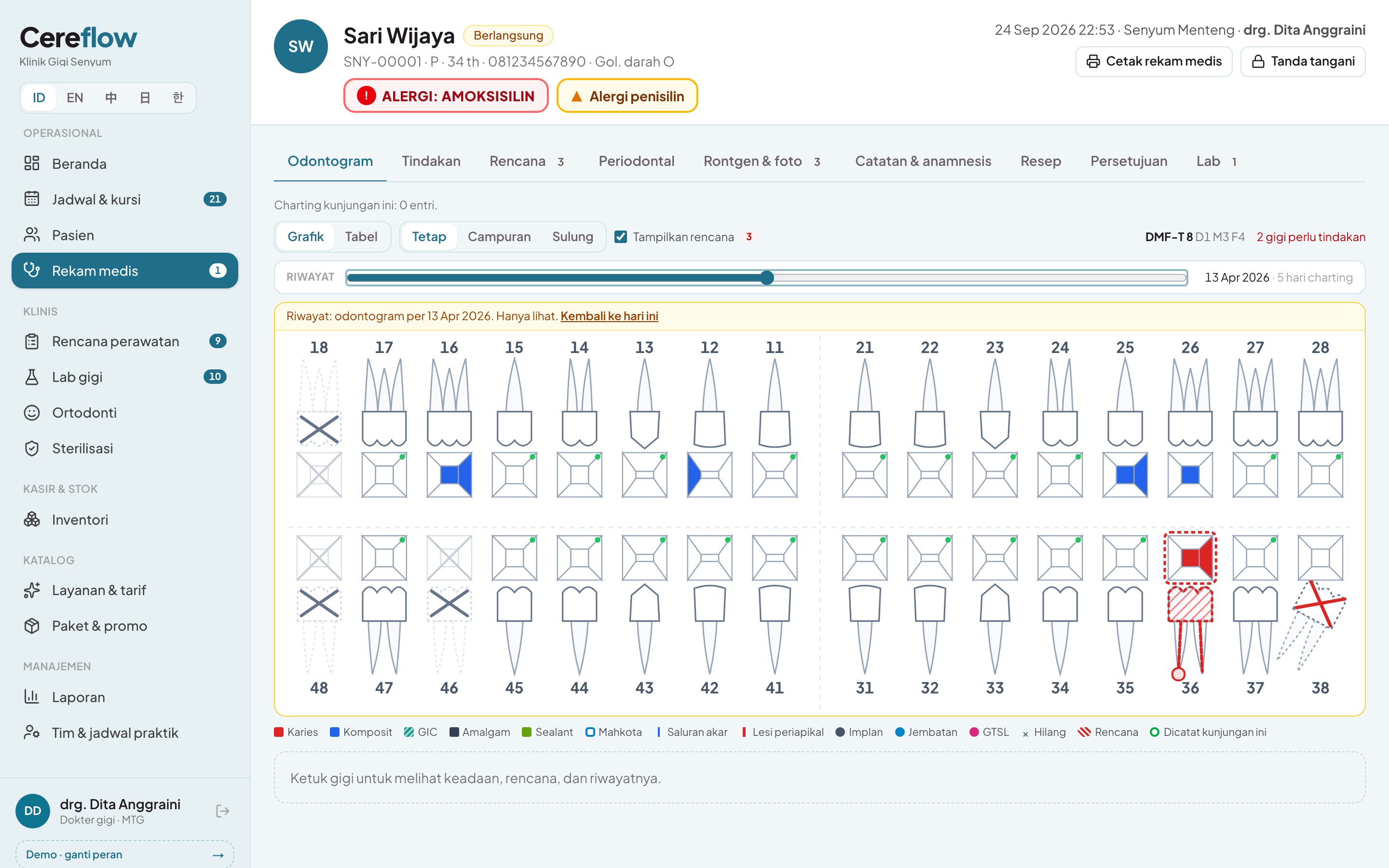 Riwayat odontogram per tanggal