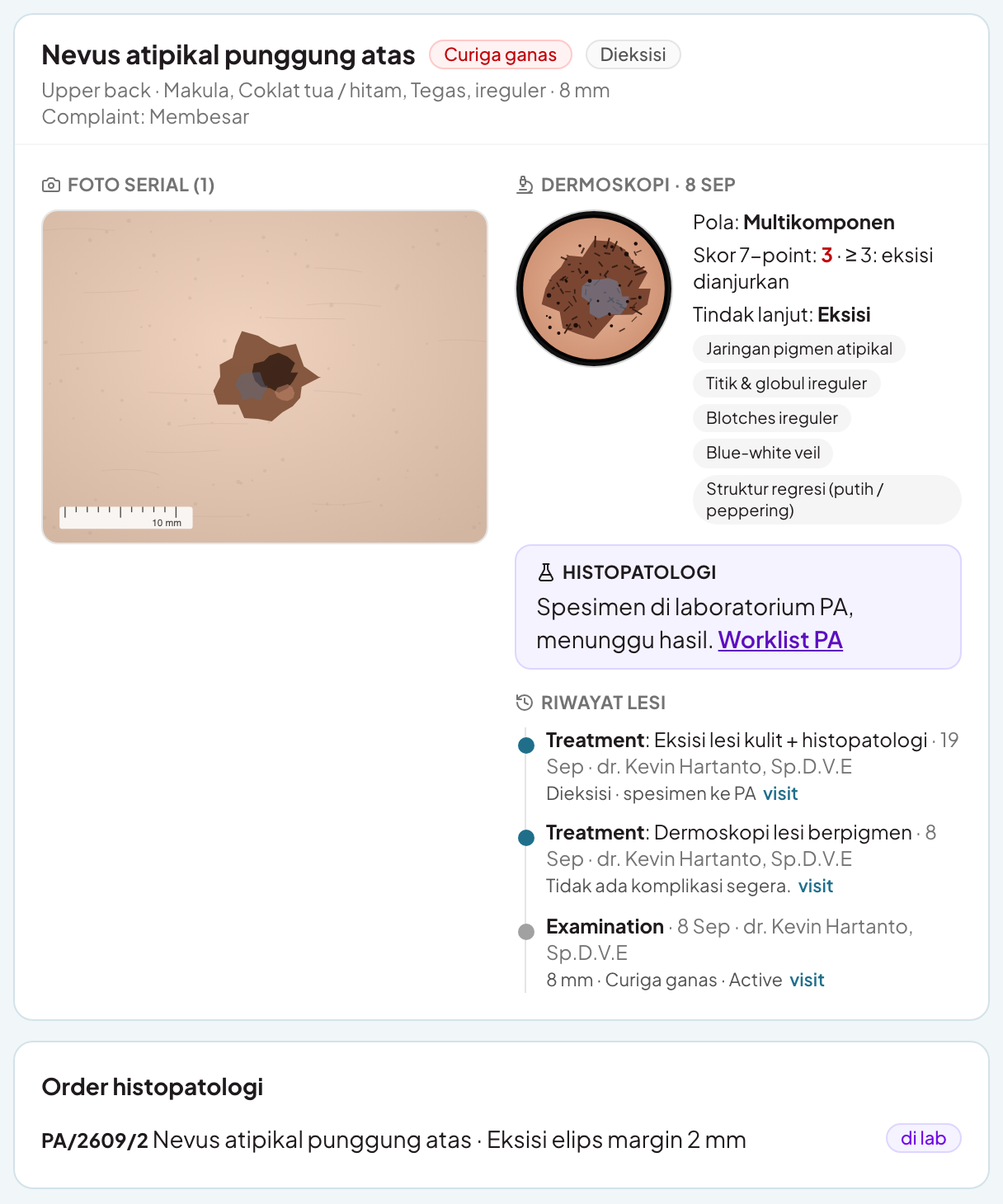 Dermoscopy