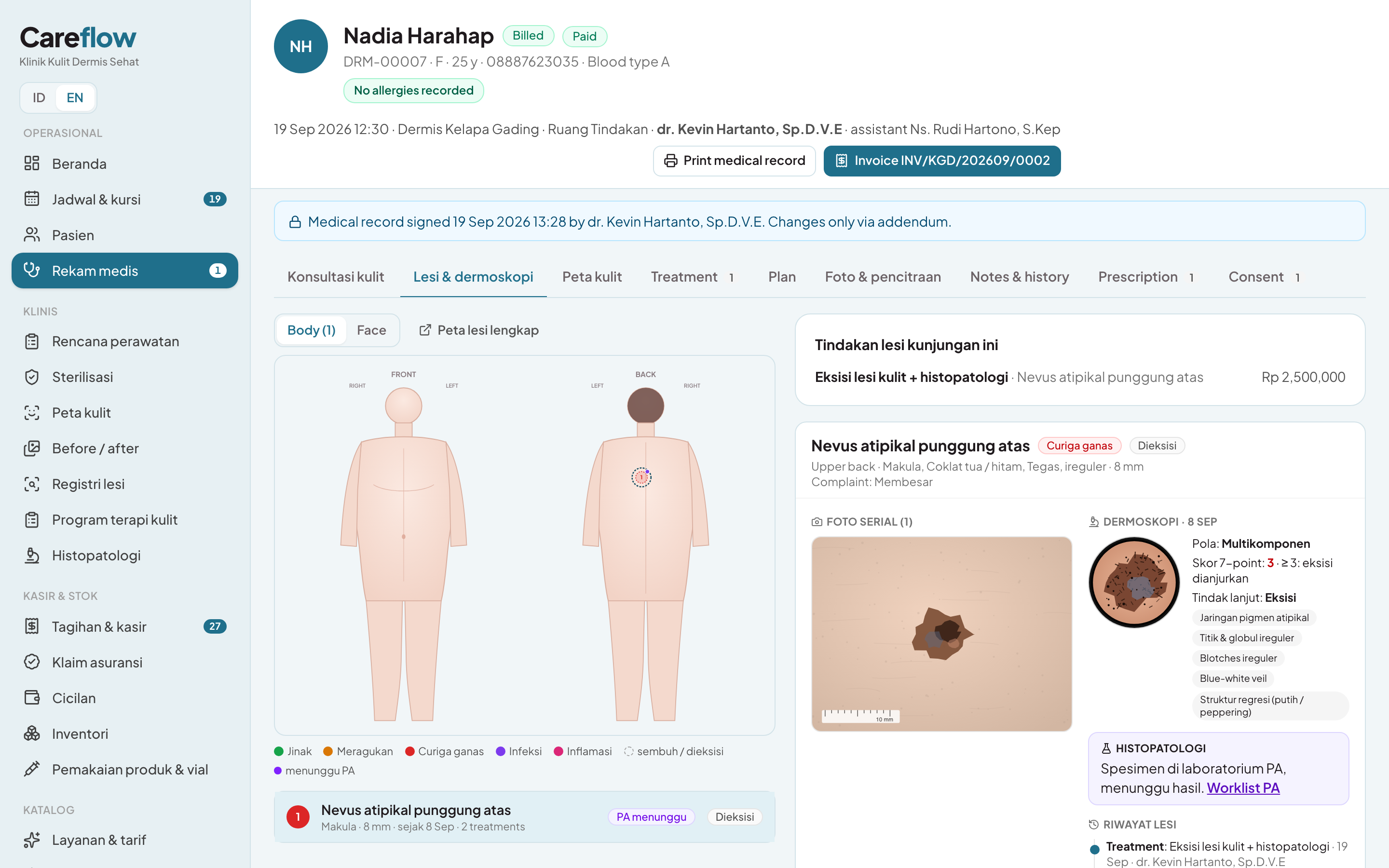 Lesions as sites
