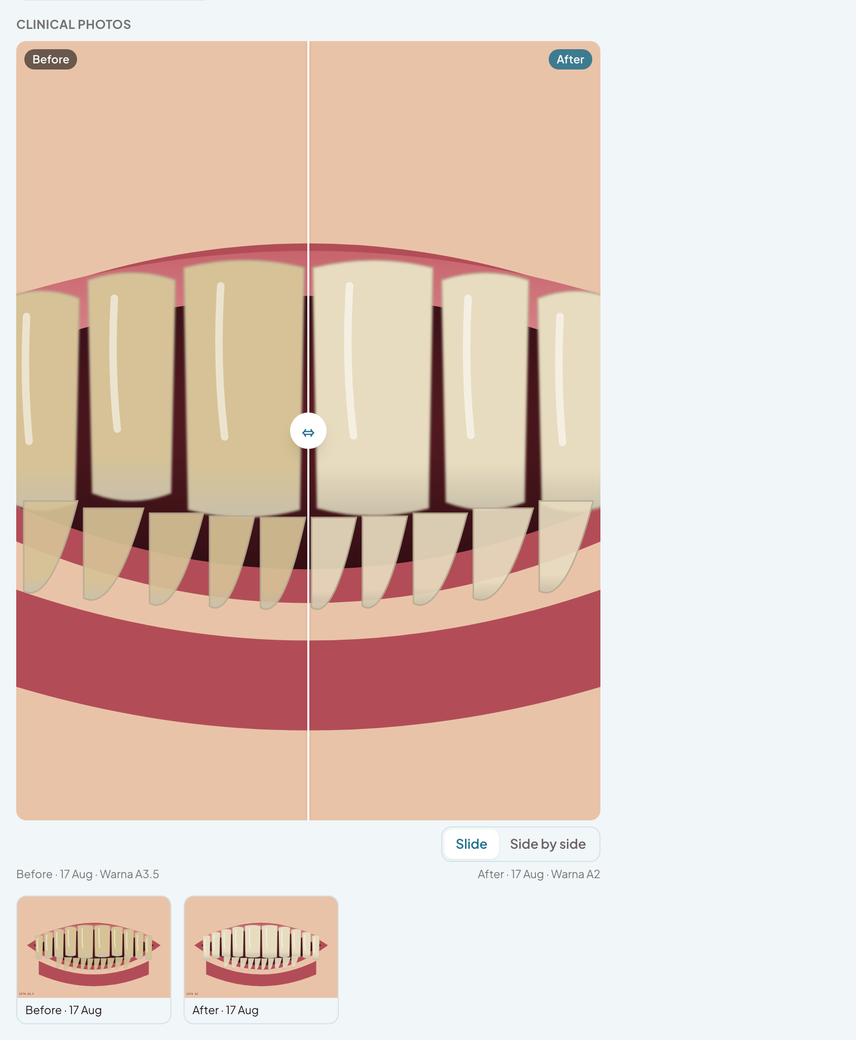 Intraoral before and after photos
