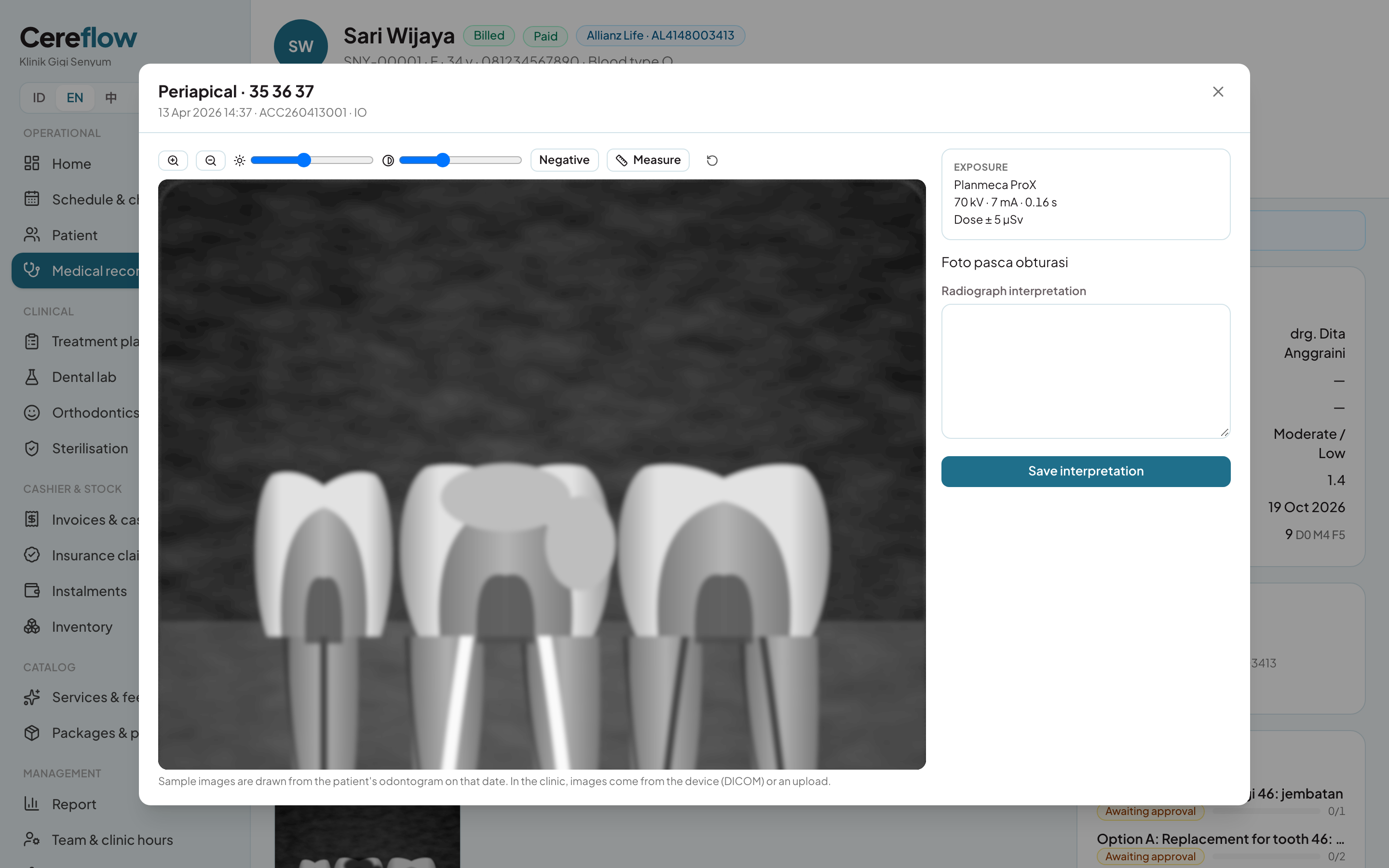 Radiograph viewer and reading