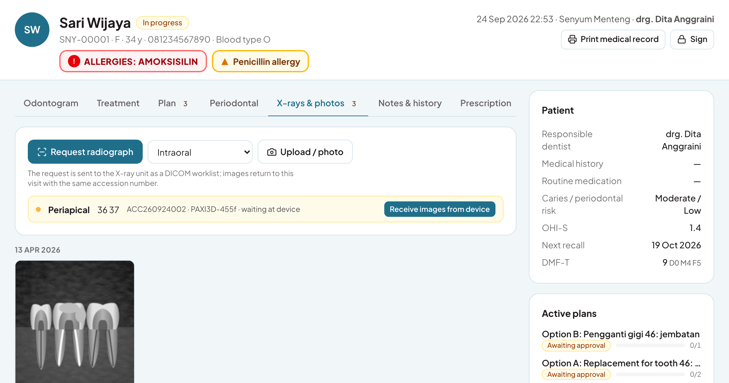 X-ray orders as a DICOM worklist