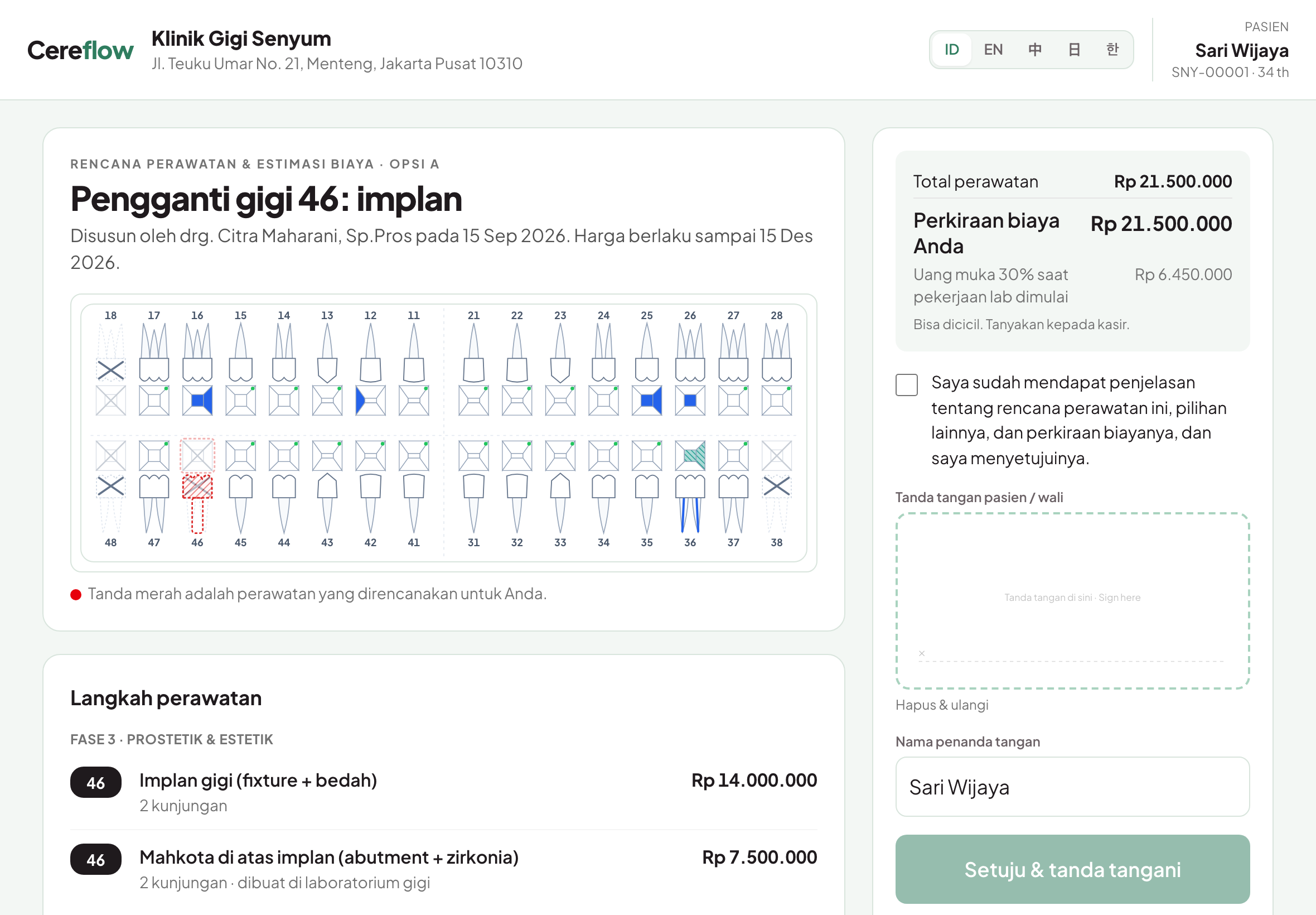 Tanda tangan di layar, di iPad, atau di aplikasi
