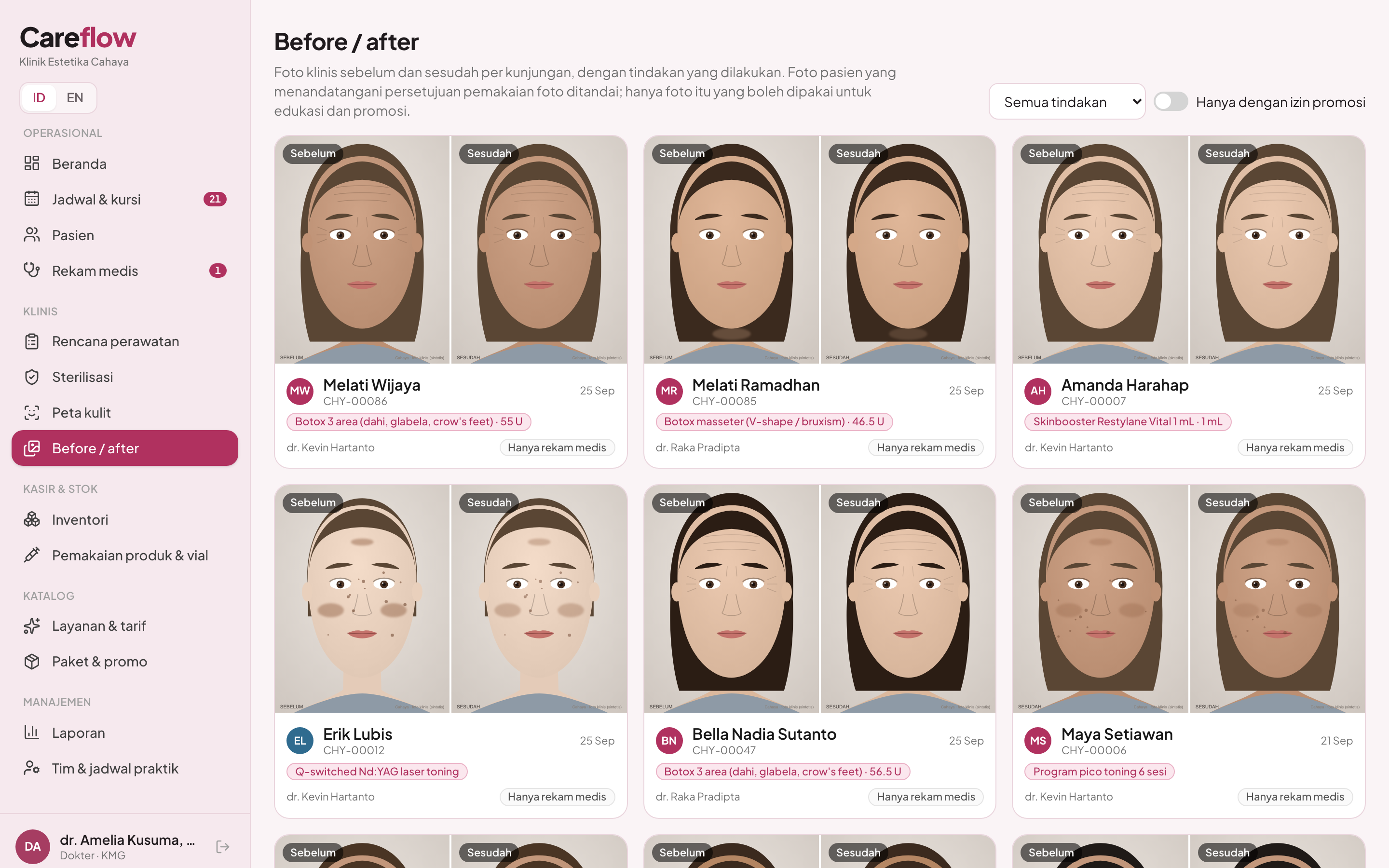 Before-after