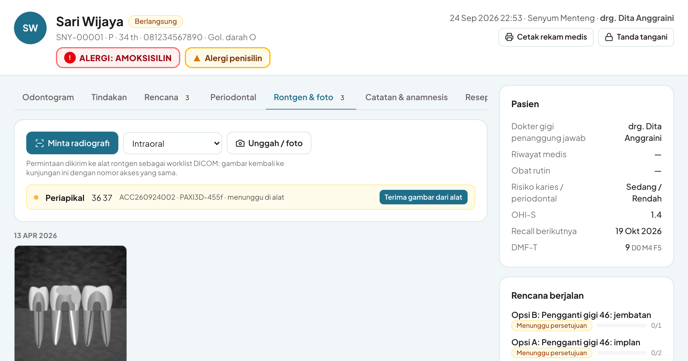 Order rontgen sebagai worklist DICOM